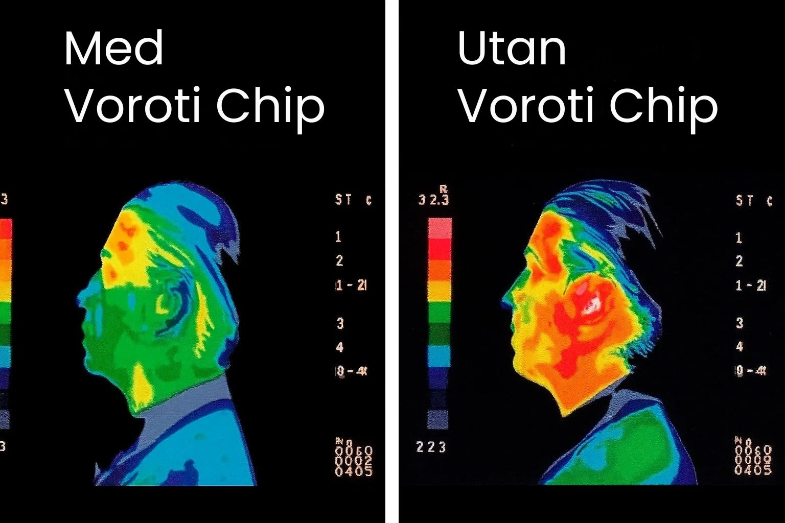 Voroti chip